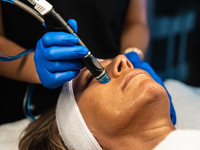A close-up of a HydraFacial tip on a patient's cheek