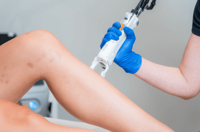 A patient during a skin-renewal facial treatment