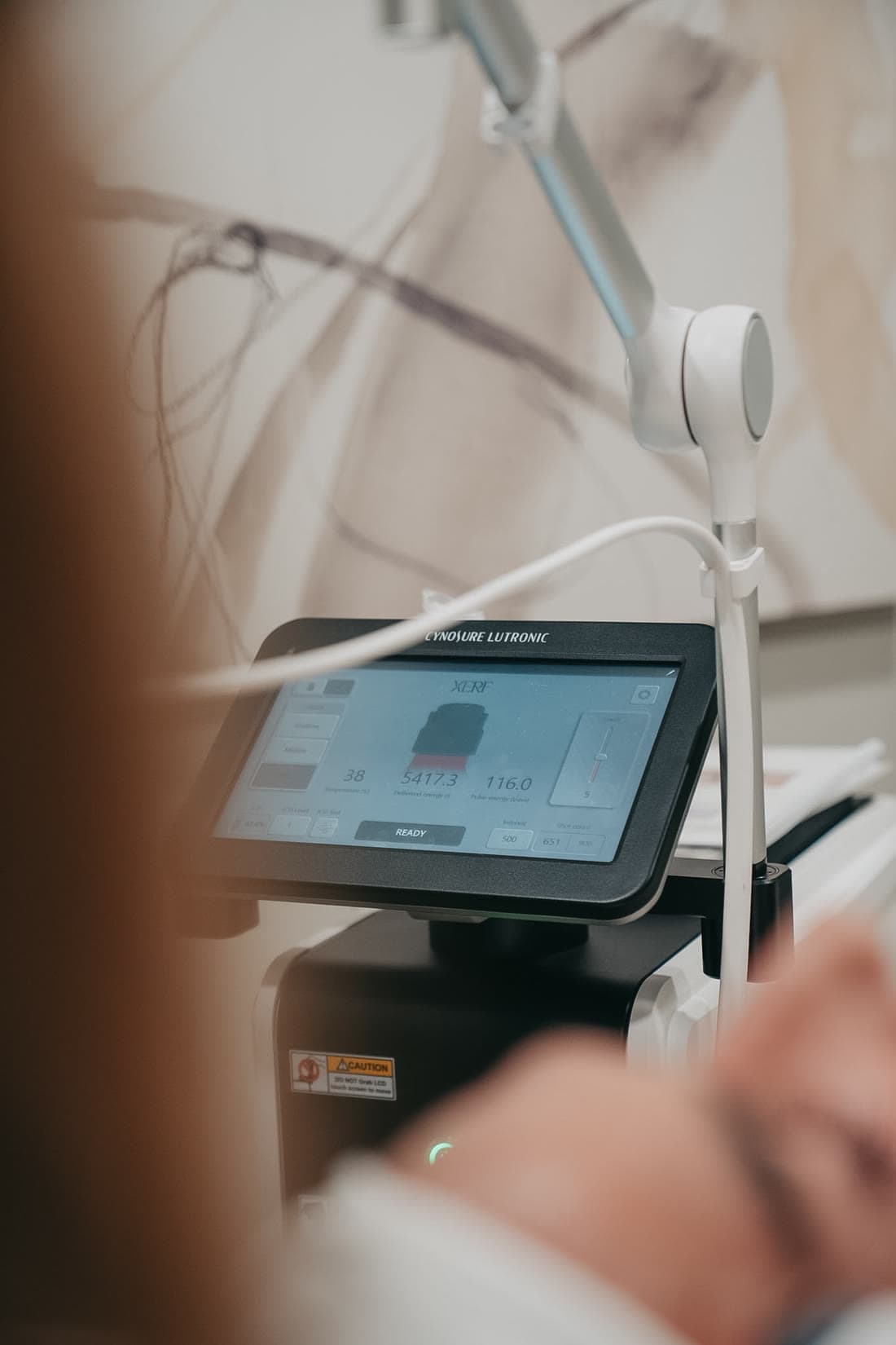The Cynosure Lutronic XERF system in a treatment room at Relive Health Stuart