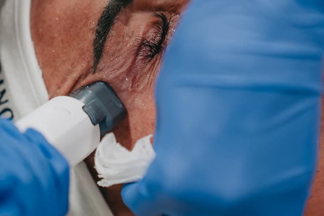 The XERF handpiece being used around the eye area