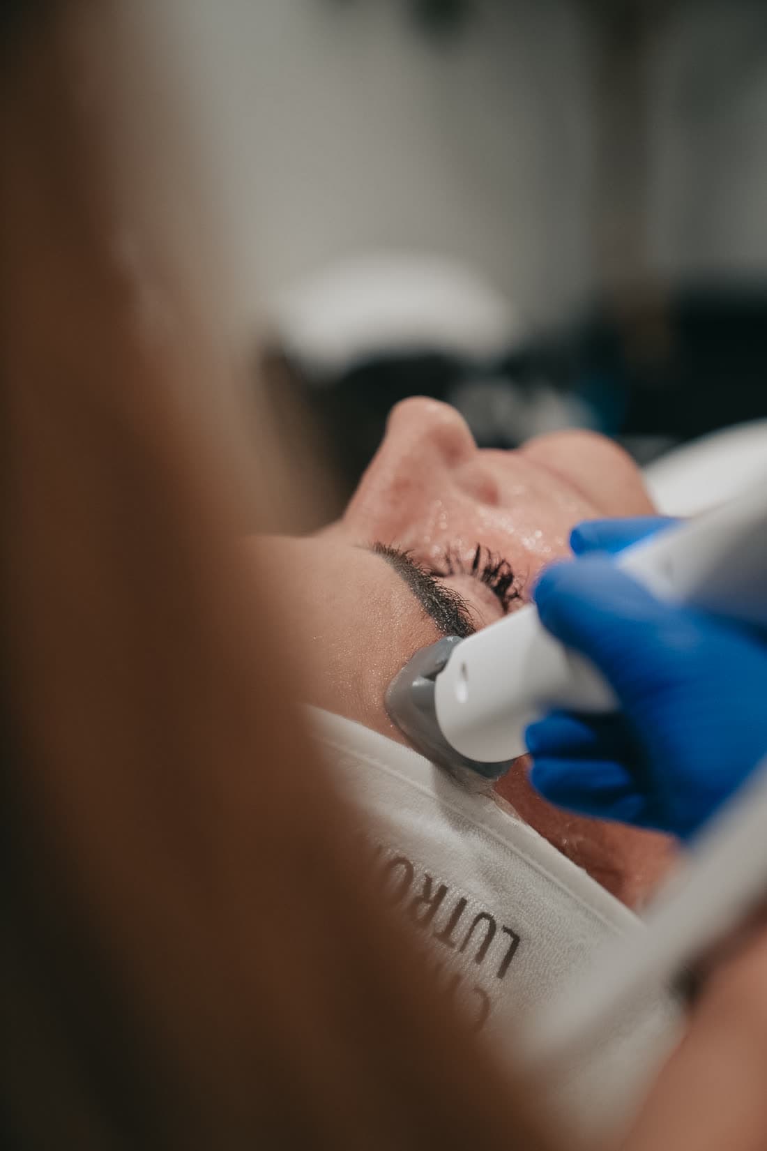 A patient's face being treated with the XERF handpiece at Relive Health Stuart