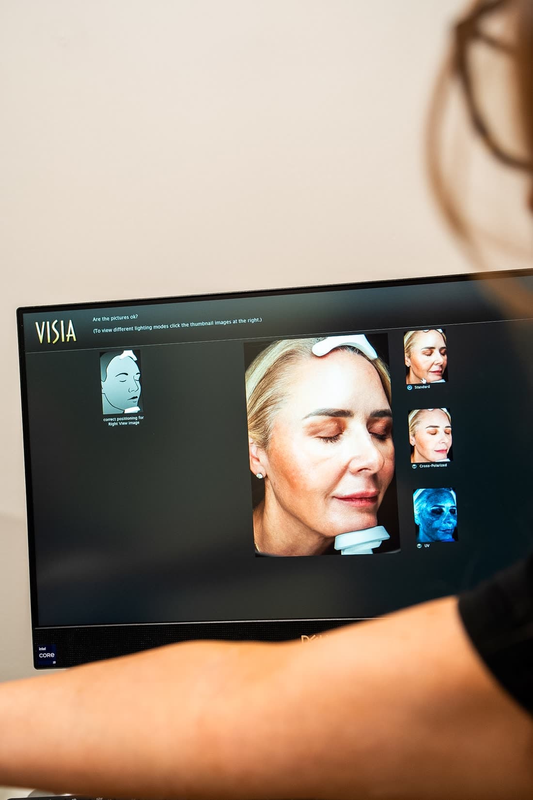 A provider walking through a patient's Visia skin analysis on screen